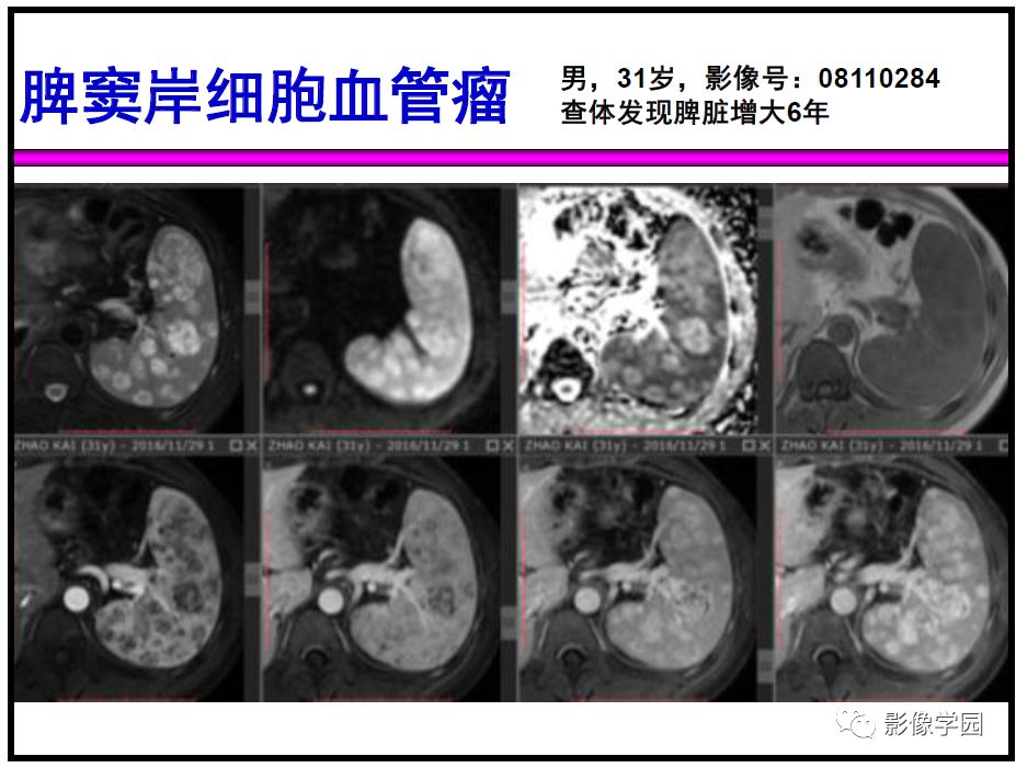 【PPT】