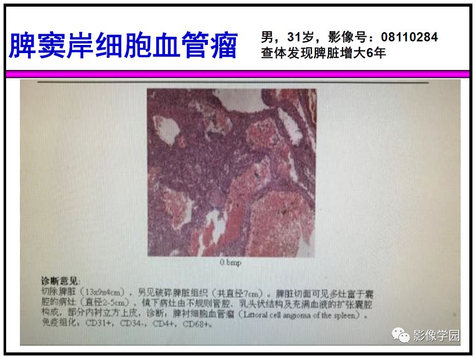 【PPT】