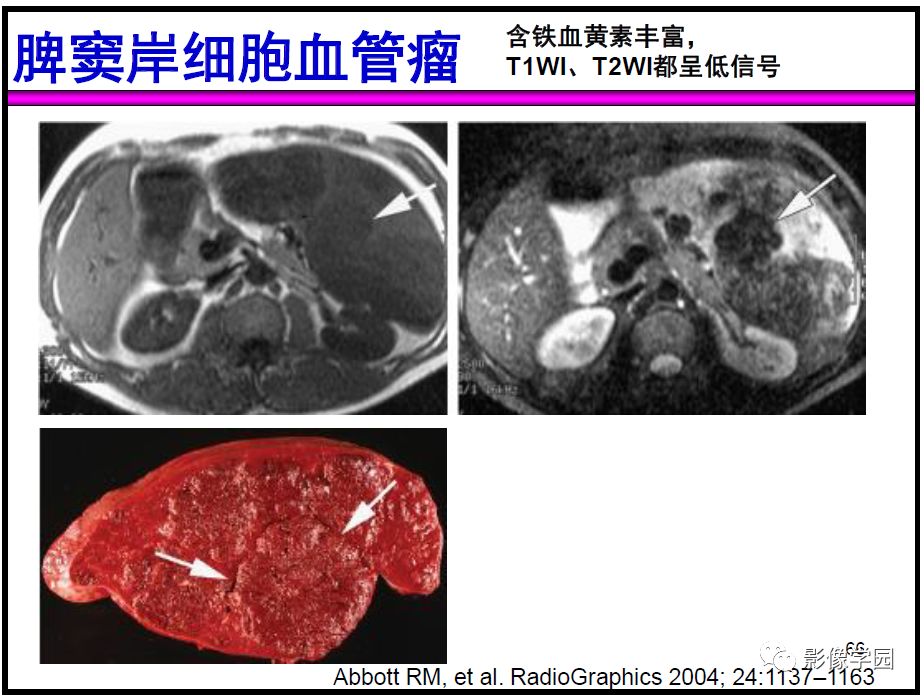 【PPT】