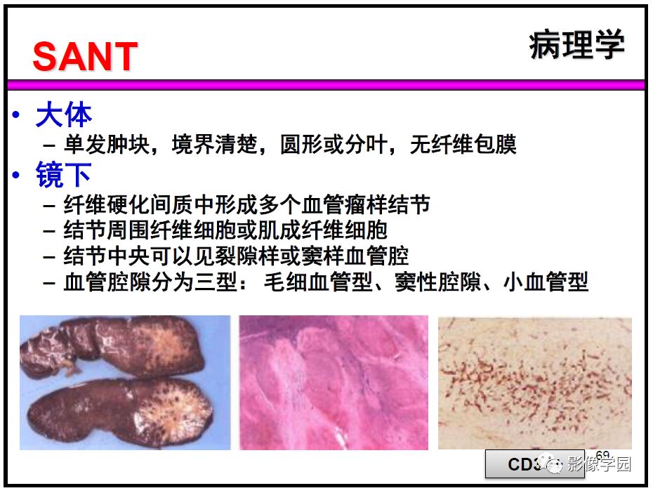 【PPT】