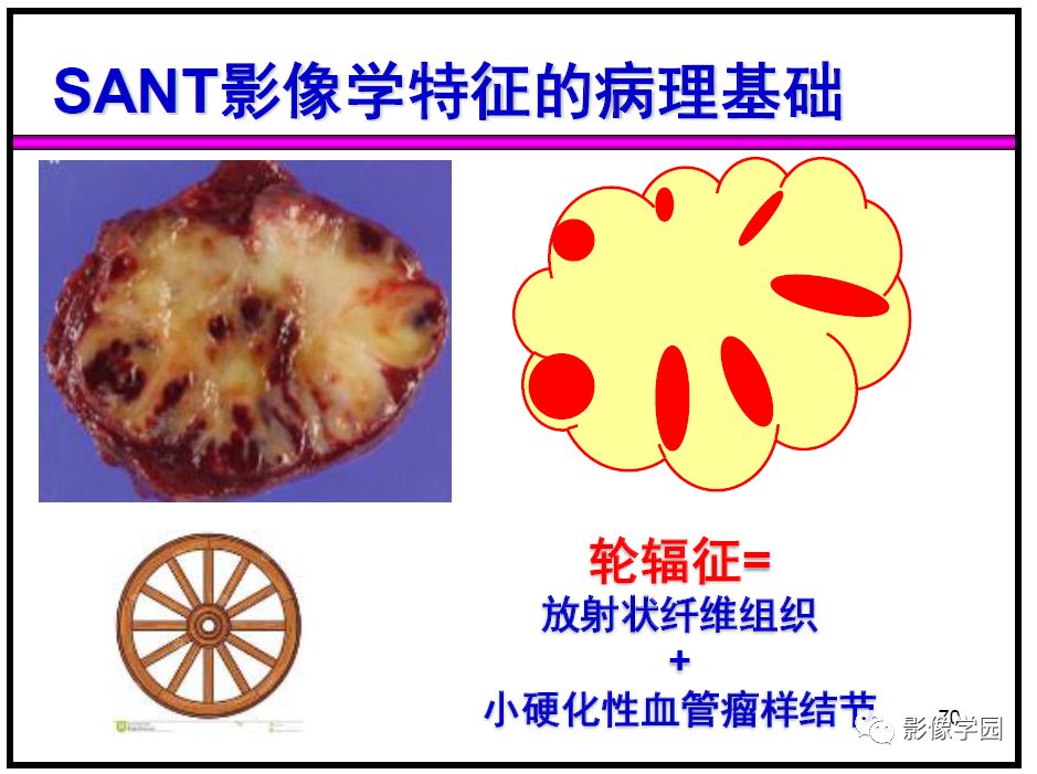 【PPT】
