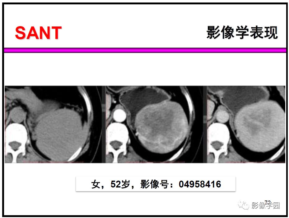【PPT】