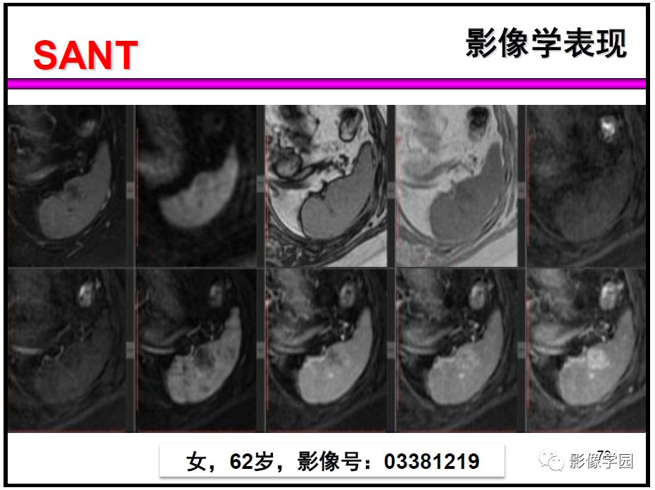 【PPT】
