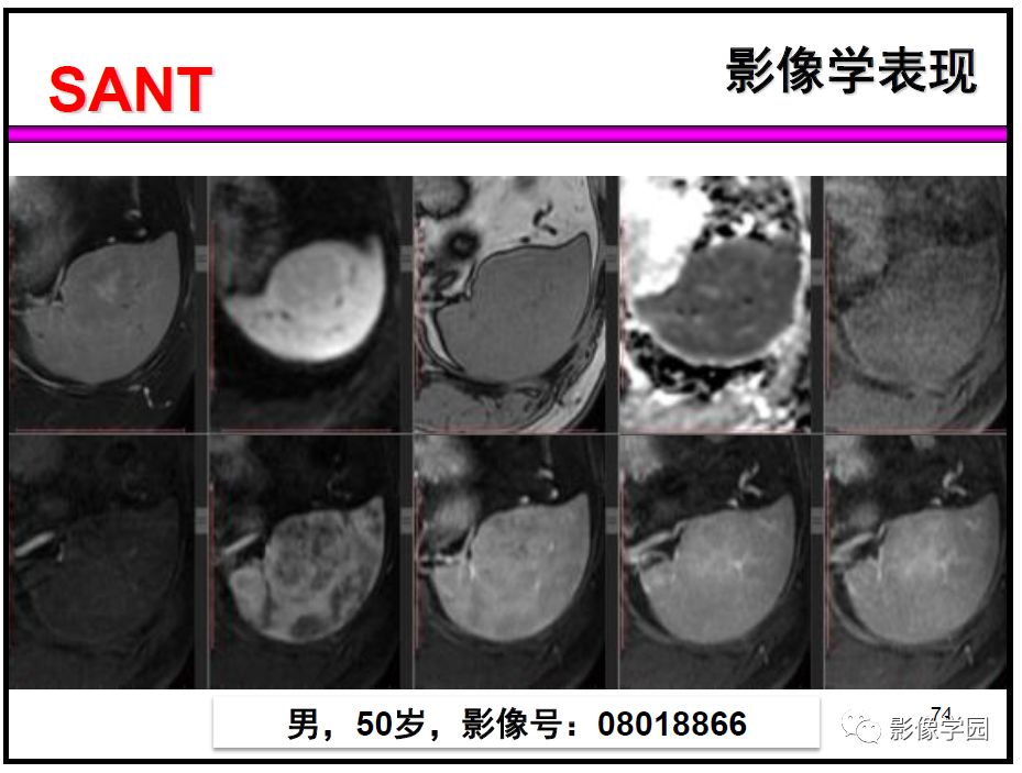 【PPT】