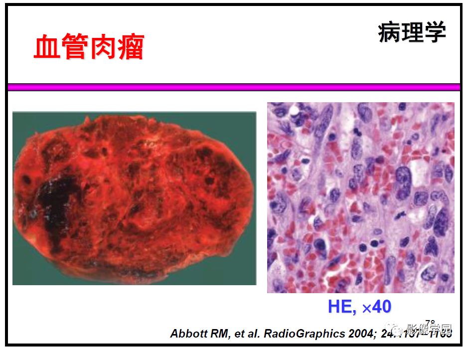 【PPT】