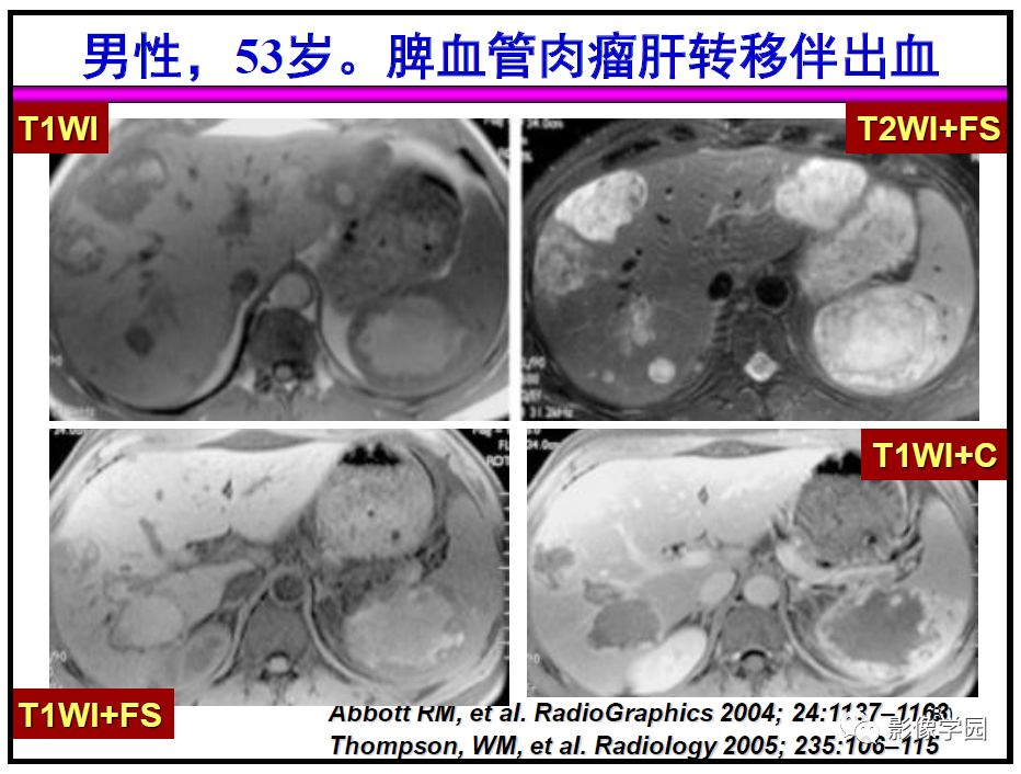 【PPT】