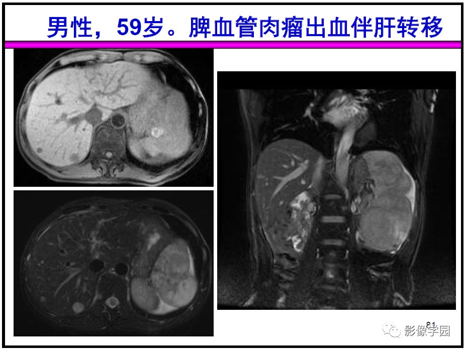 【PPT】
