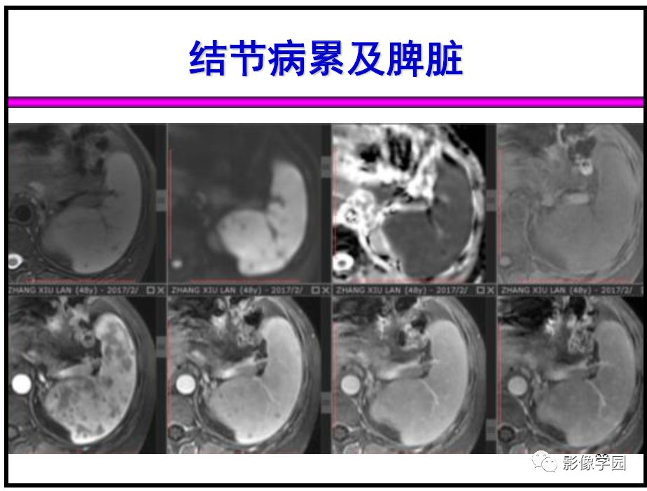 【PPT】