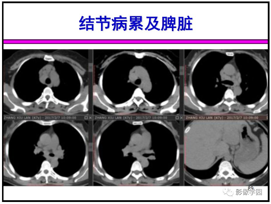 【PPT】