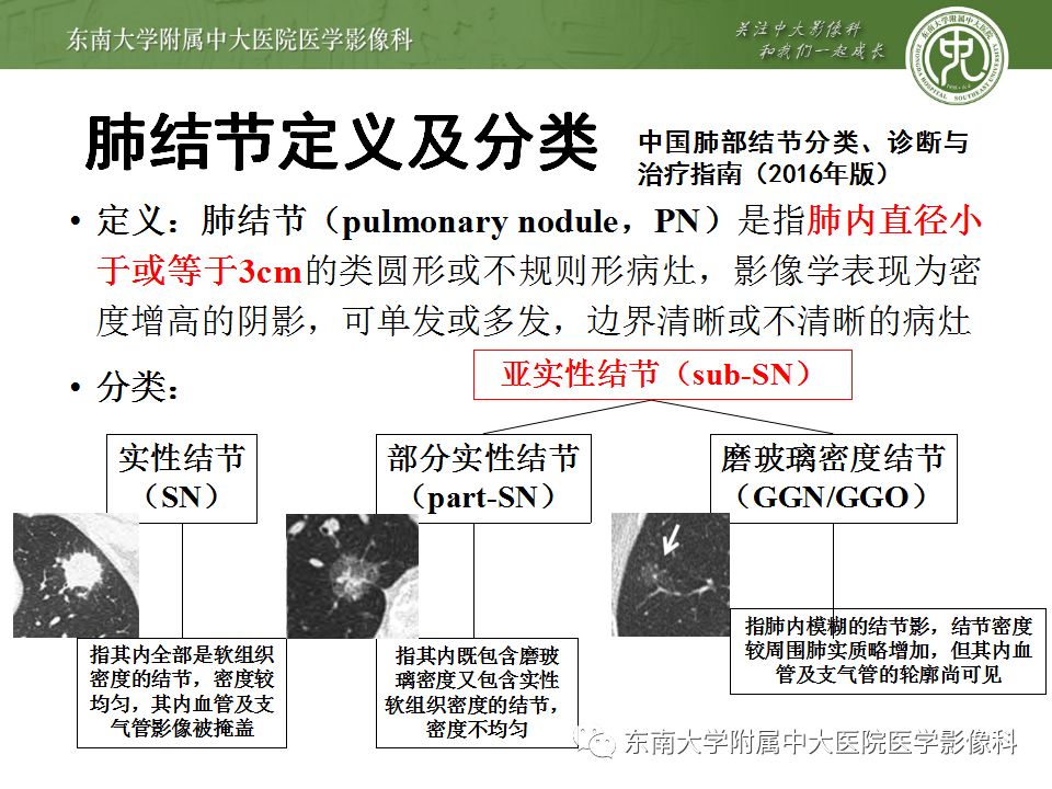 【病例】肺亚实性结节—腺癌两例CT影像表现