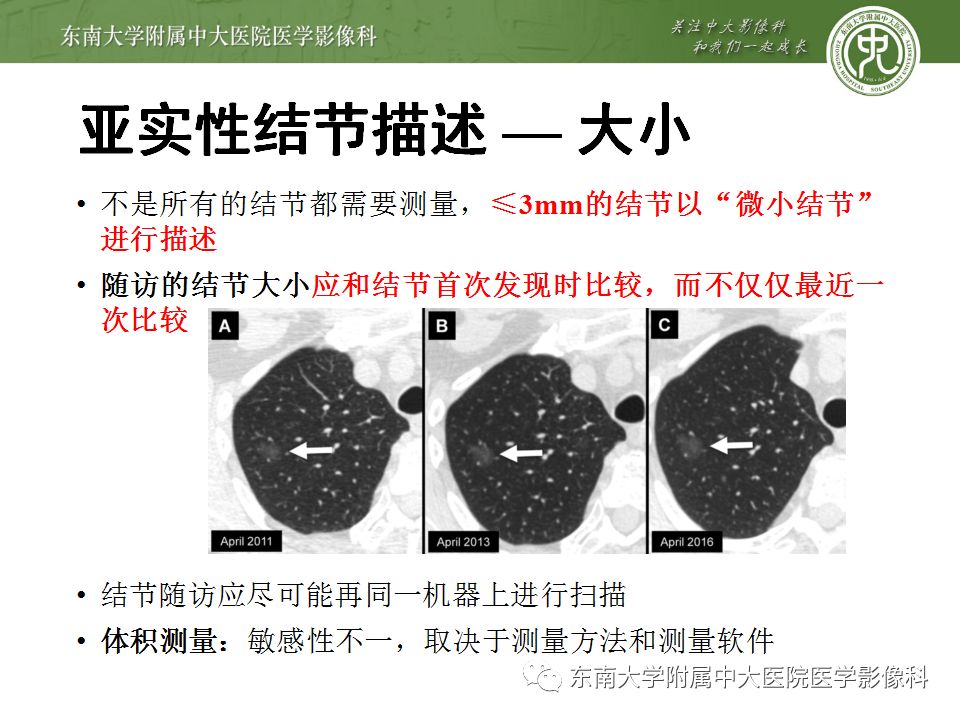 【病例】肺亚实性结节—腺癌两例CT影像表现
