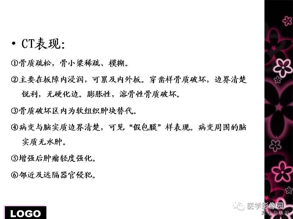 【病例】颅骨浆细胞性骨髓瘤1例CT影像表现