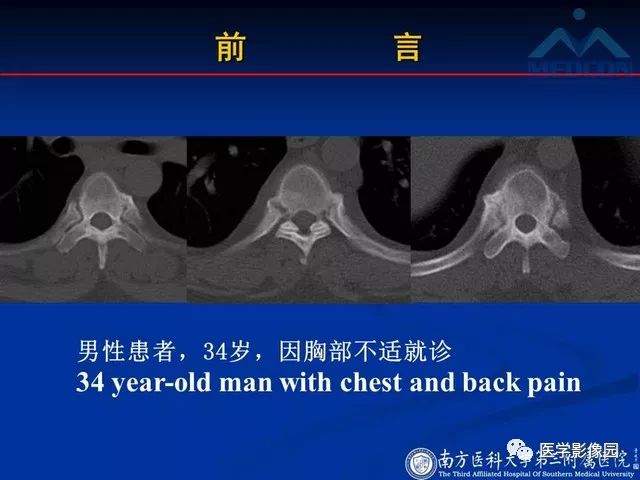 【PPT】系统性疾病脊椎侵犯病理学改变和影像学诊断