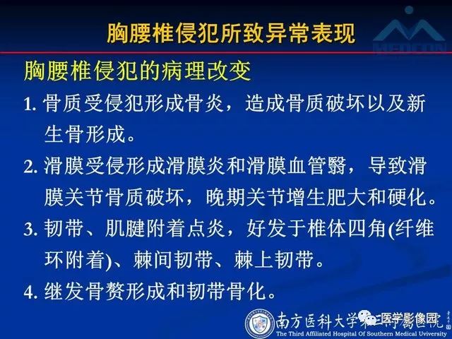 【PPT】系统性疾病脊椎侵犯病理学改变和影像学诊断