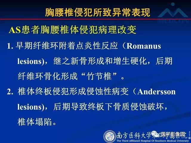 【PPT】系统性疾病脊椎侵犯病理学改变和影像学诊断