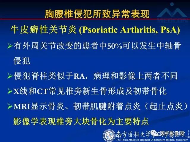 【PPT】系统性疾病脊椎侵犯病理学改变和影像学诊断