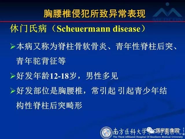 【PPT】系统性疾病脊椎侵犯病理学改变和影像学诊断
