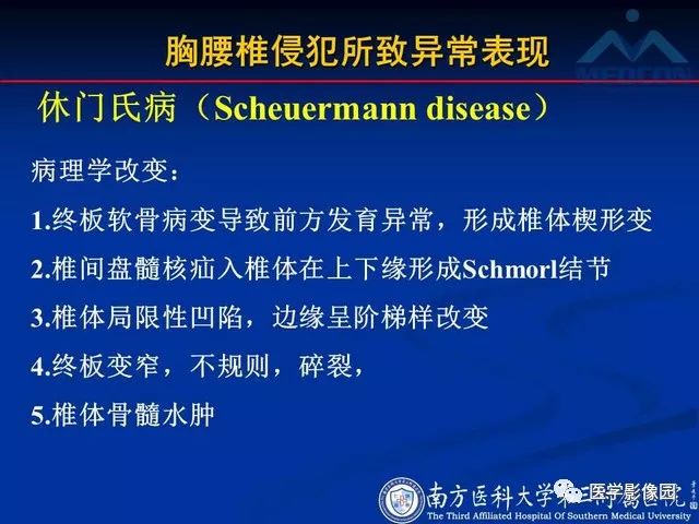 【PPT】系统性疾病脊椎侵犯病理学改变和影像学诊断
