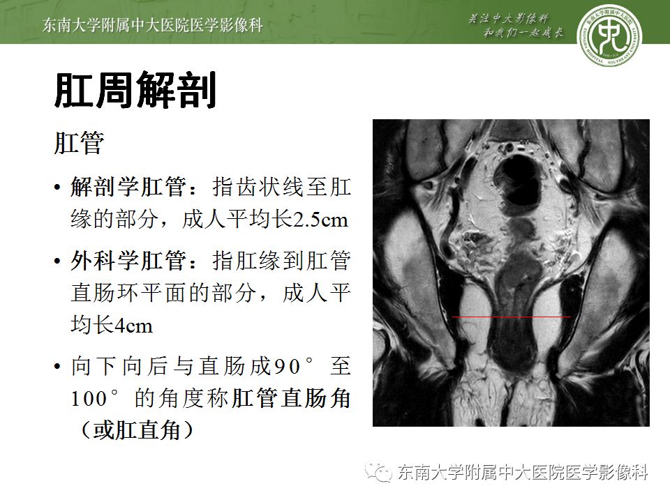【病例】肛瘘2例MR诊断及报告