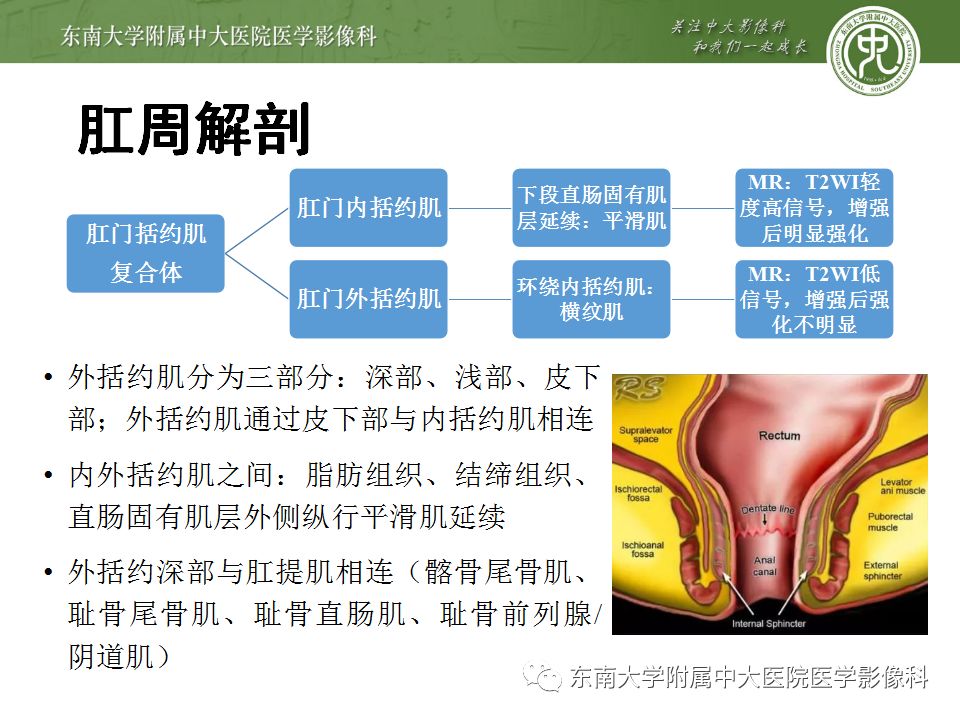 【病例】肛瘘2例MR诊断及报告