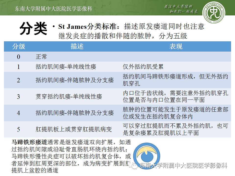 【病例】肛瘘2例MR诊断及报告