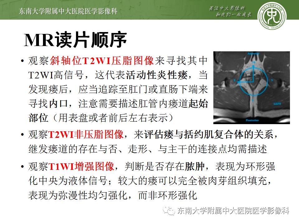 【病例】肛瘘2例MR诊断及报告