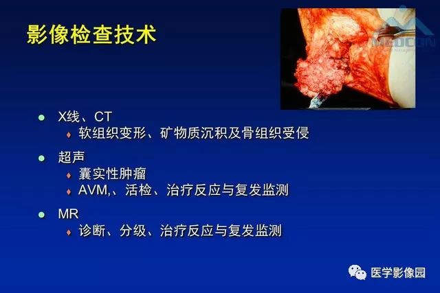 【PPT】软组织肿瘤鉴别诊断：MR作用