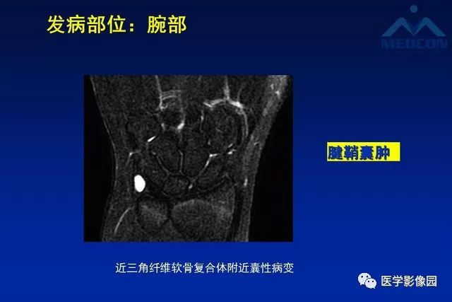 【PPT】软组织肿瘤鉴别诊断：MR作用
