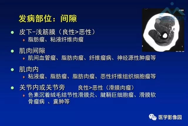 【PPT】软组织肿瘤鉴别诊断：MR作用