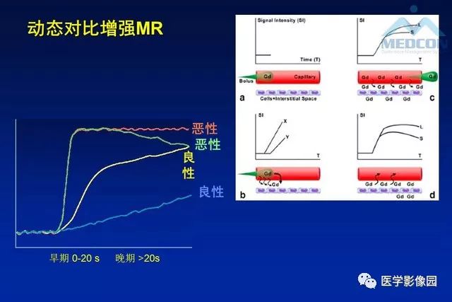 【PPT】软组织肿瘤鉴别诊断：MR作用