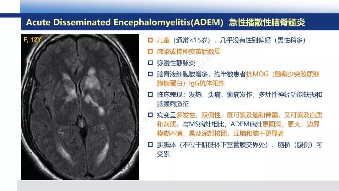【PPT】脑白质病变影像与病理