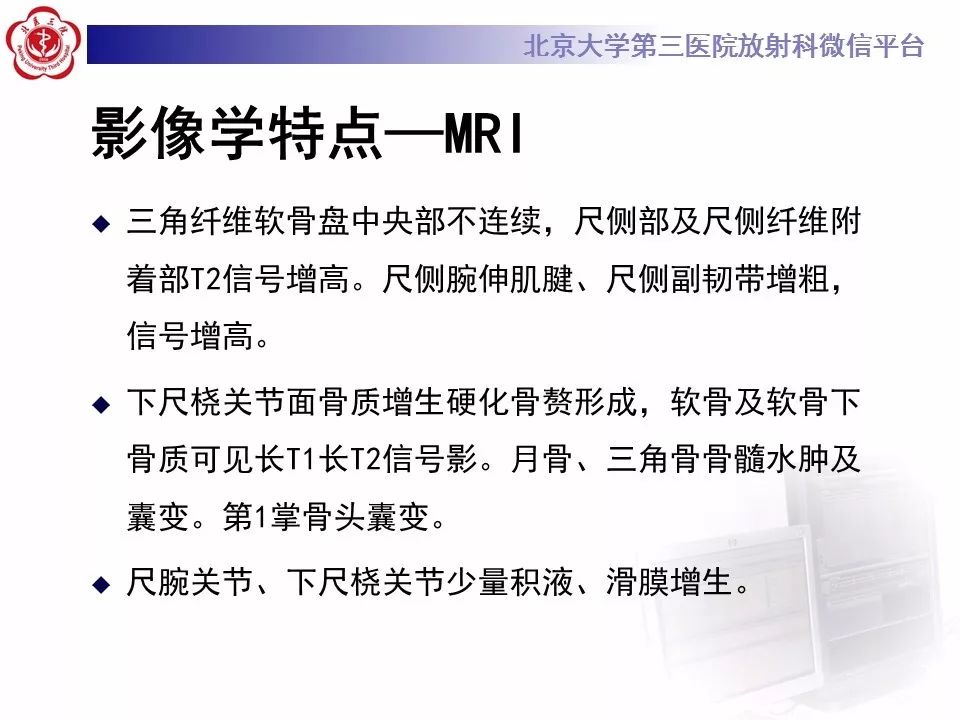 【病例】尺骨撞击综合征1例X线及MR影像表现
