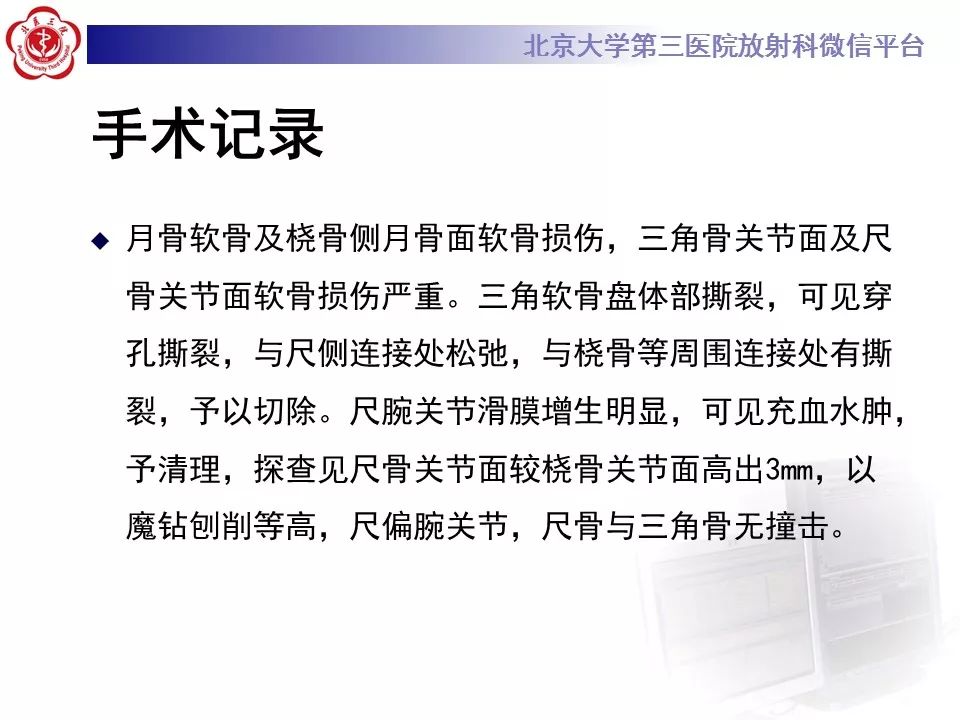 【病例】尺骨撞击综合征1例X线及MR影像表现