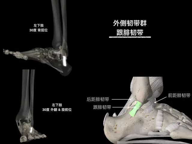 【PPT】踝关节韧带解剖学