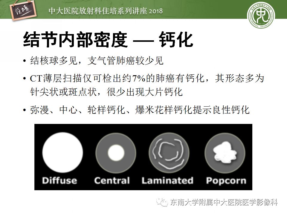 【PPT】 肺部结节与肿块的影像诊断与鉴别诊断