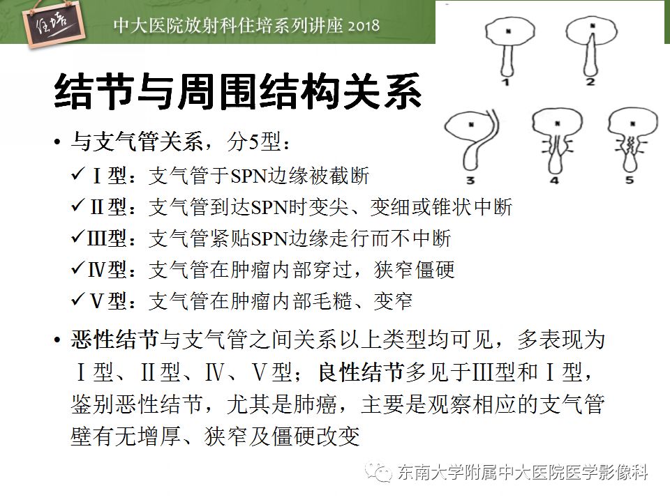 【PPT】 肺部结节与肿块的影像诊断与鉴别诊断