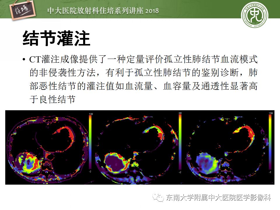 【PPT】 肺部结节与肿块的影像诊断与鉴别诊断