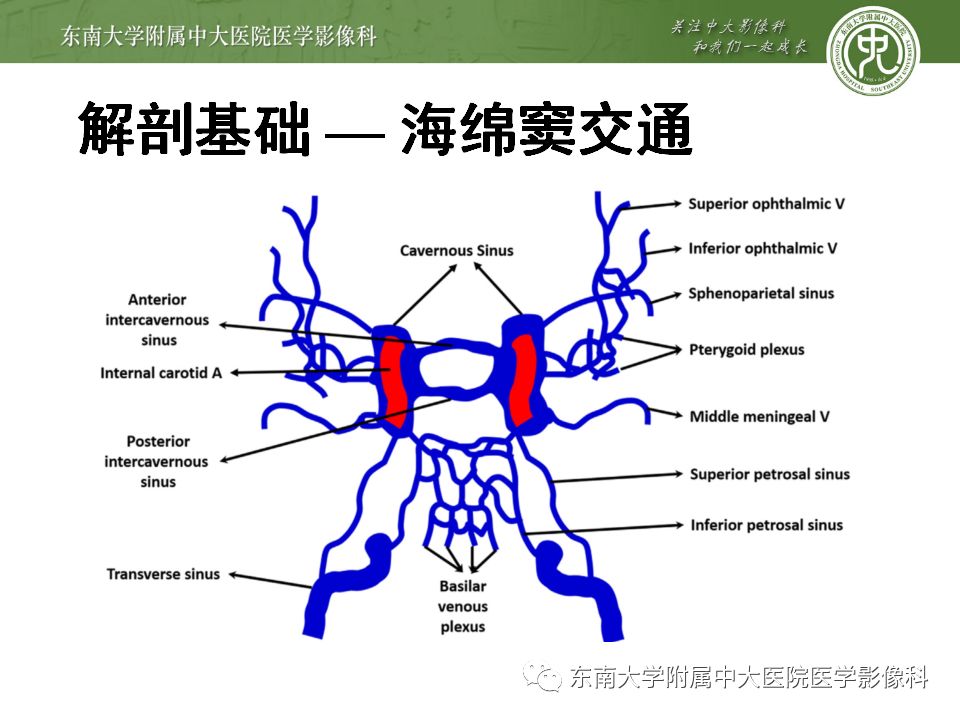 【病例】右侧动眼神经鞘瘤1例MR