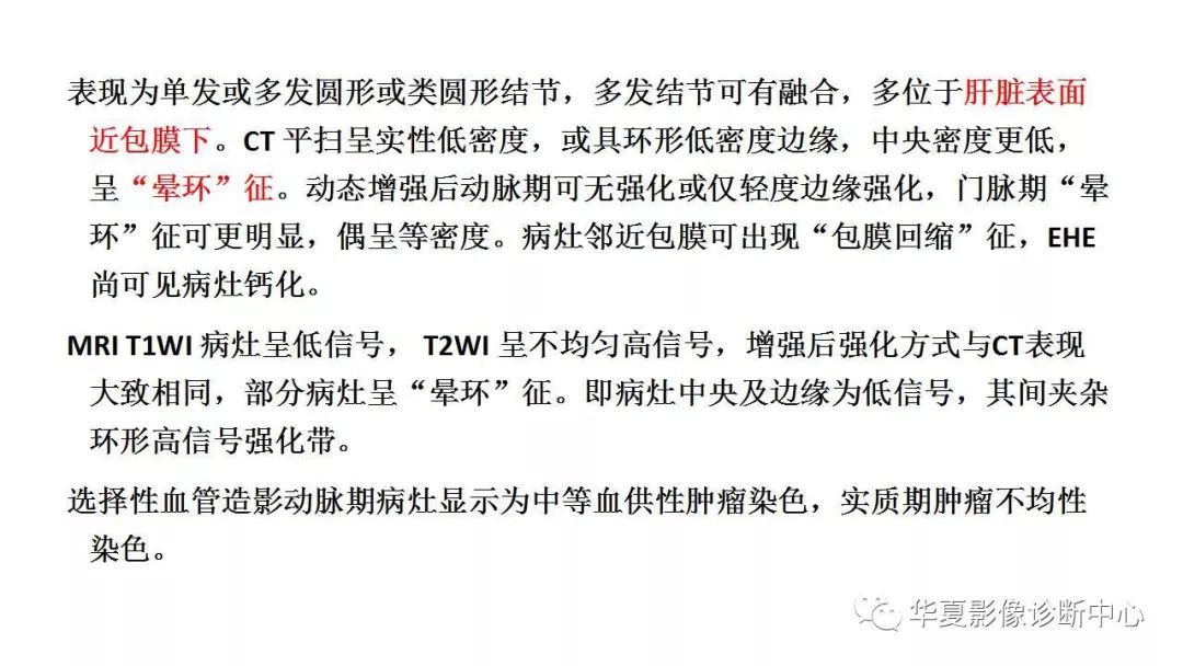 【病例】肝脏上皮样血管内皮瘤1例CT及MR影像表现