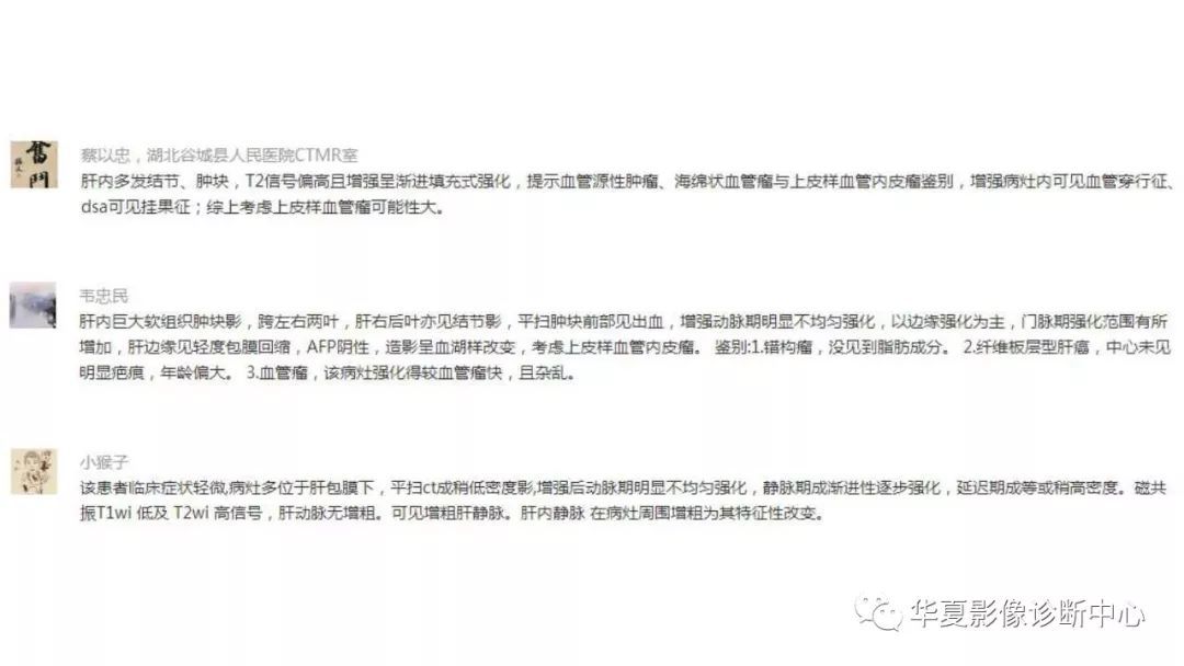 【病例】肝脏上皮样血管内皮瘤1例CT及MR影像表现