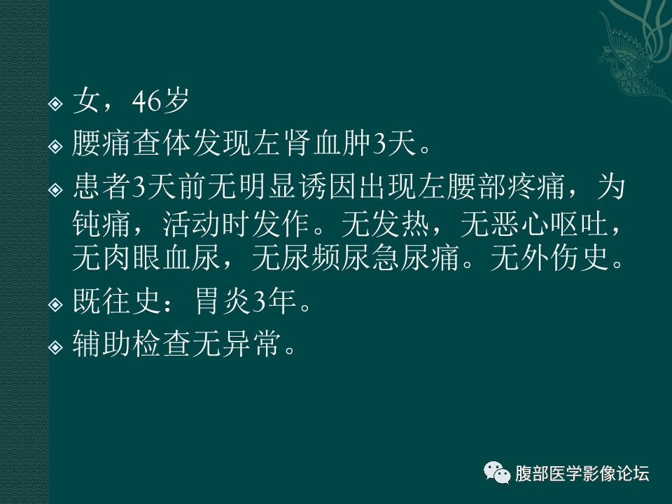 【病例】腹膜后嗜铬细胞瘤1例CT影像表现