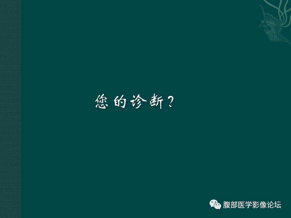 【病例】腹膜后嗜铬细胞瘤1例CT影像表现