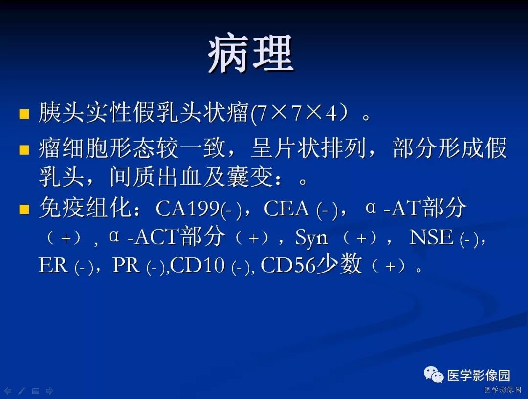【病例】胰腺实性假乳头状瘤1例CT影像表现