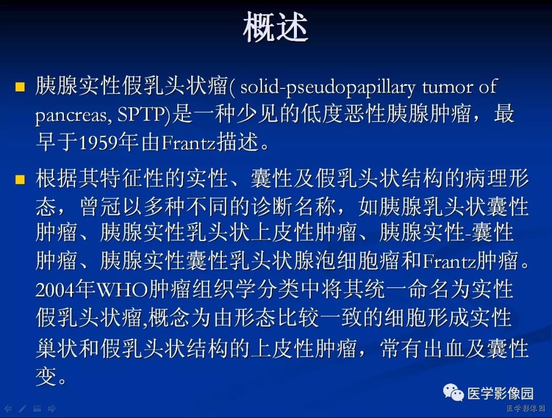 【病例】胰腺实性假乳头状瘤1例CT影像表现