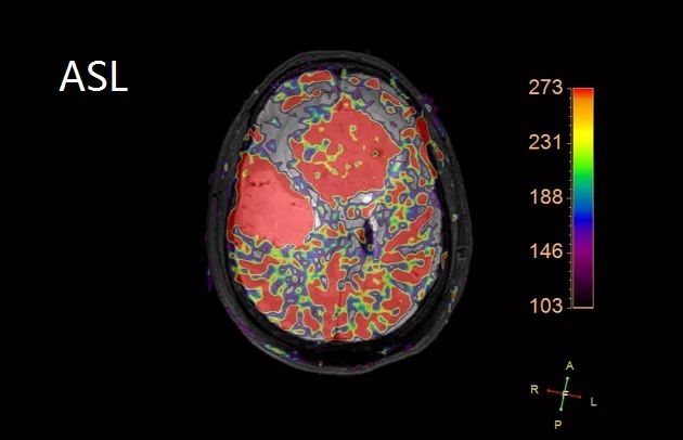 两种简单的疾病合在一起,你还敢诊断吗? 两种简单的疾病合在一起,你还敢诊断吗?
