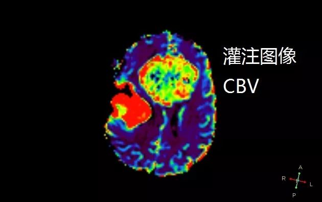 两种简单的疾病合在一起,你还敢诊断吗? 两种简单的疾病合在一起,你还敢诊断吗?