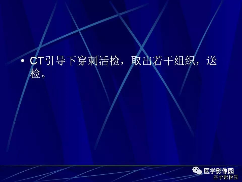【病例】肝脏巨大血管平滑肌脂肪瘤1例CT影像表现