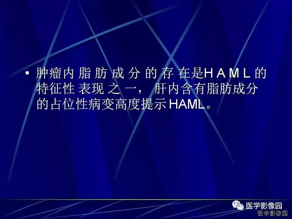 【病例】肝脏巨大血管平滑肌脂肪瘤1例CT影像表现
