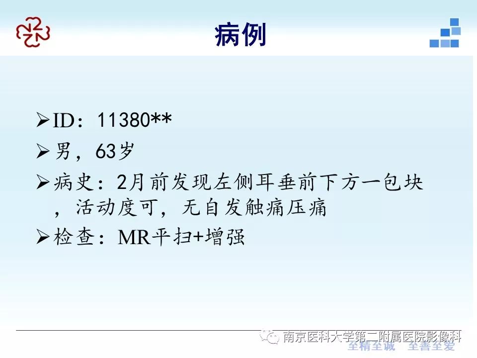 【PPT】腮腺腺淋巴瘤的影像学表现