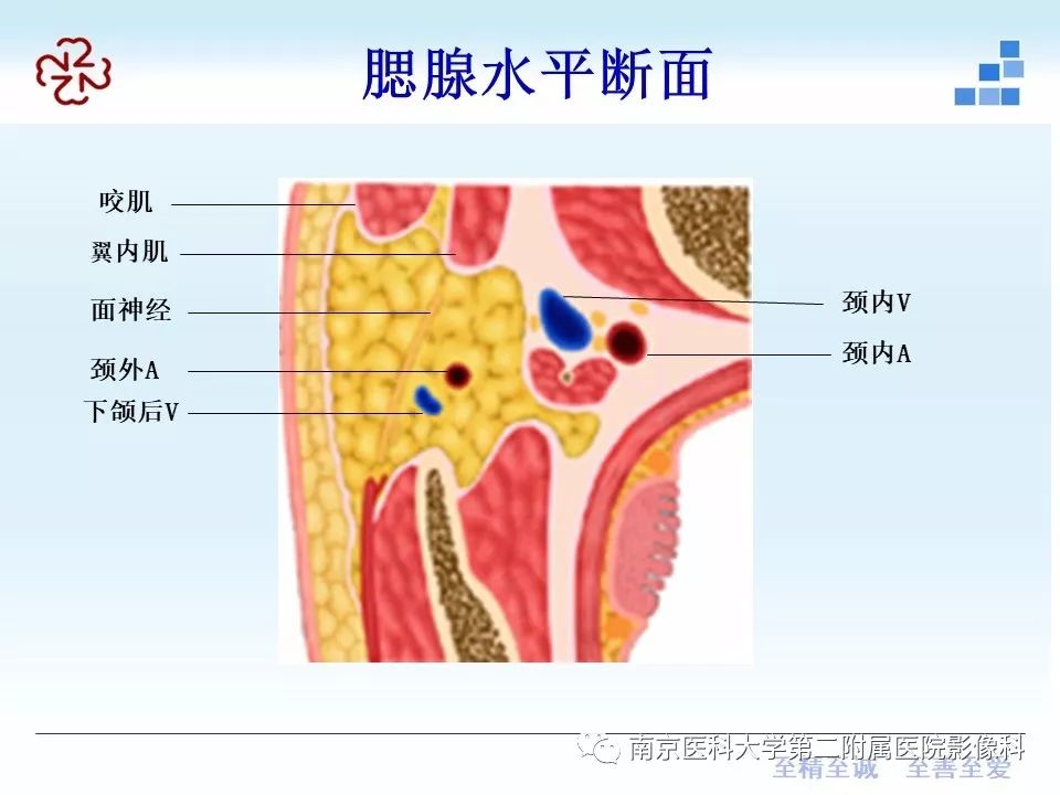 【PPT】腮腺腺淋巴瘤的影像学表现